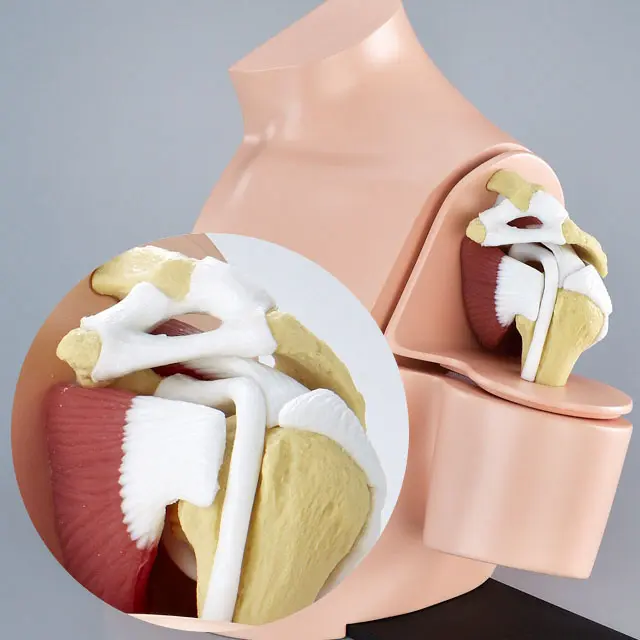 肩板修復モデル